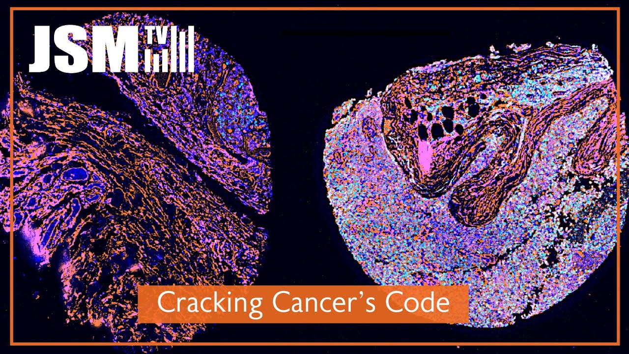 Math Revolutionizing Cancer Research | Irving Institute for Cancer Dynamics, Columbia University
