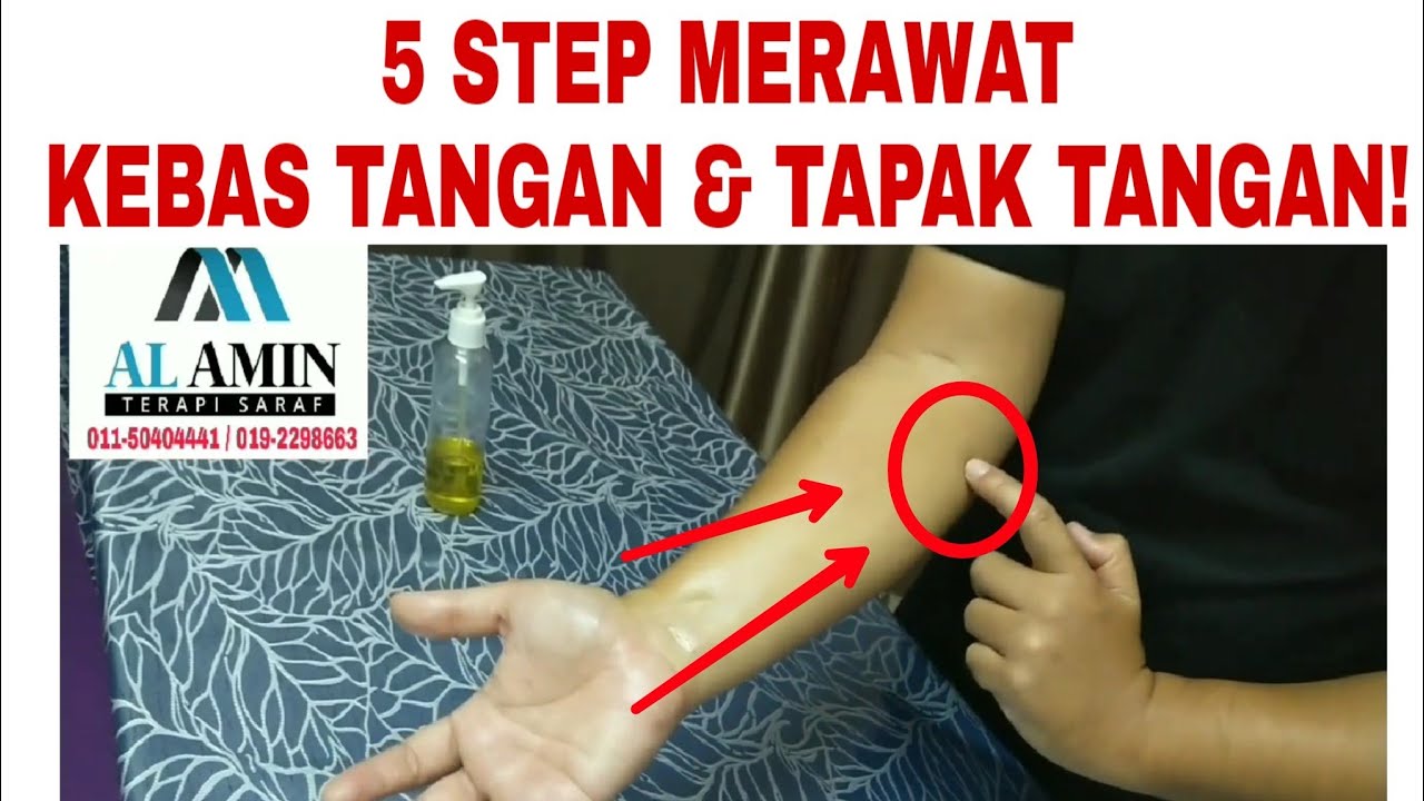 Urut Kebas Tangan & Tapak Tangan | Carpal Tunnel Sindrom | 011-50404441
