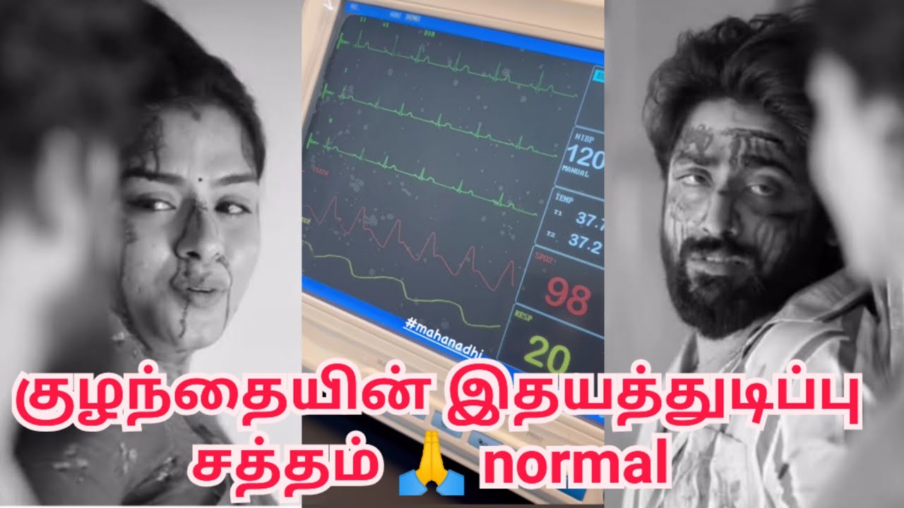 குழந்தையின் இதயத்துடிப்பு சத்தம் 🙏 normal