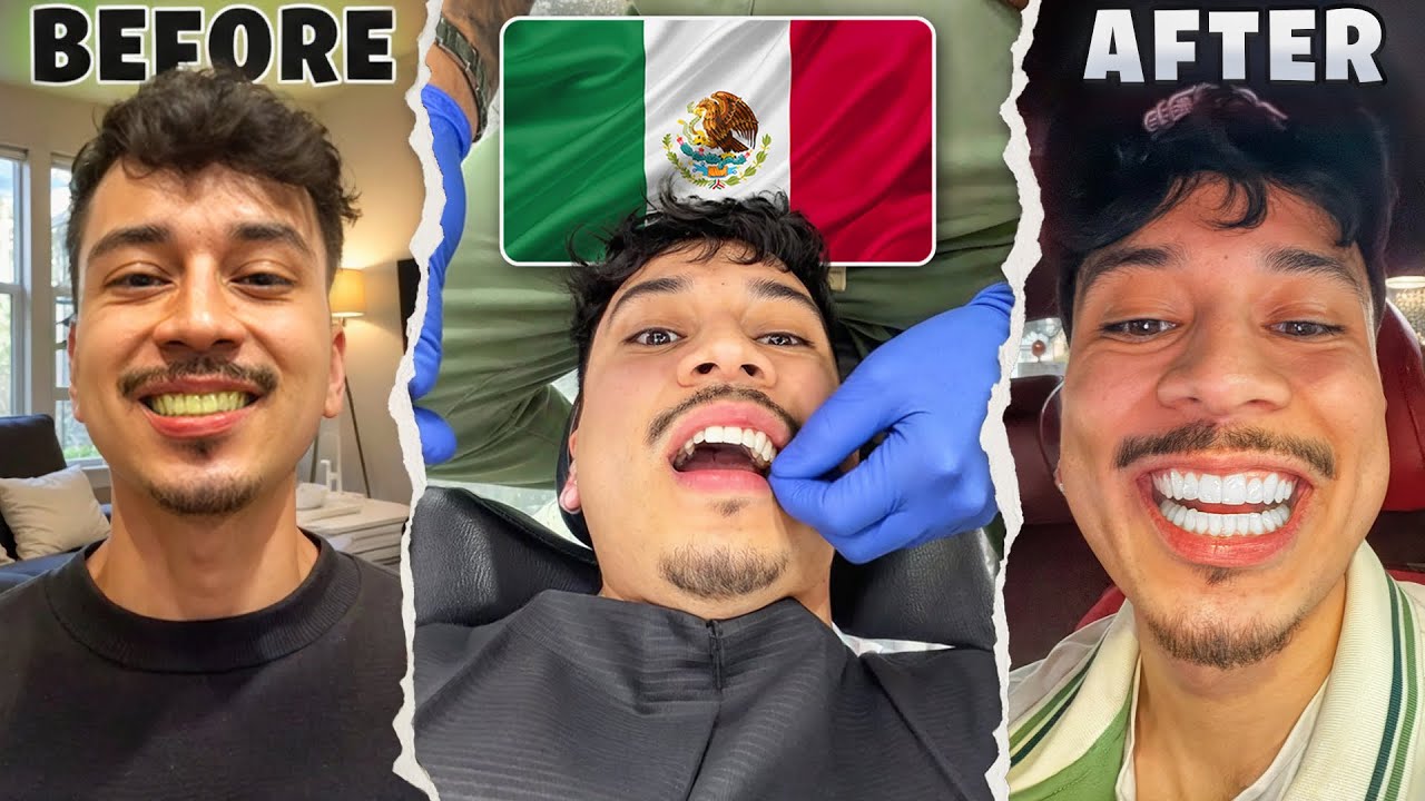 I GOT MY TEETH DONE IN MEXICO!!! (GONE WRONG)