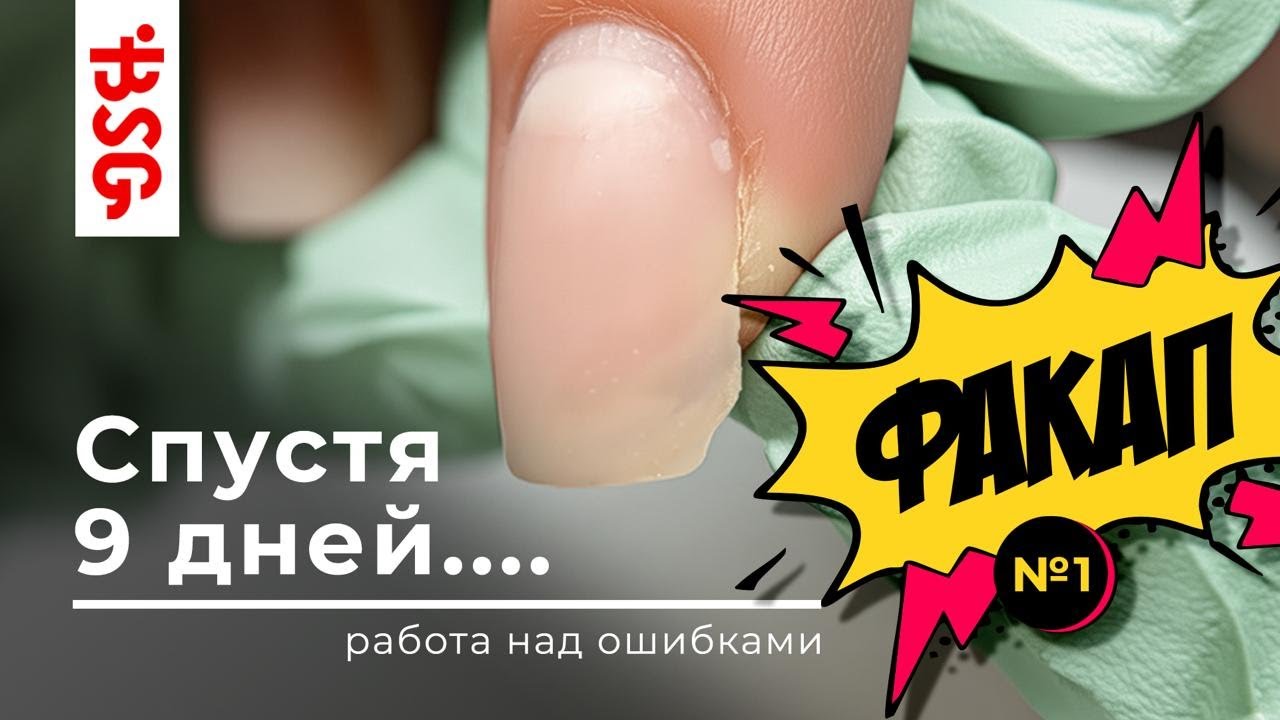ФАКАП на коротком квадрате: почему техника не сработала и как этого избежать💥