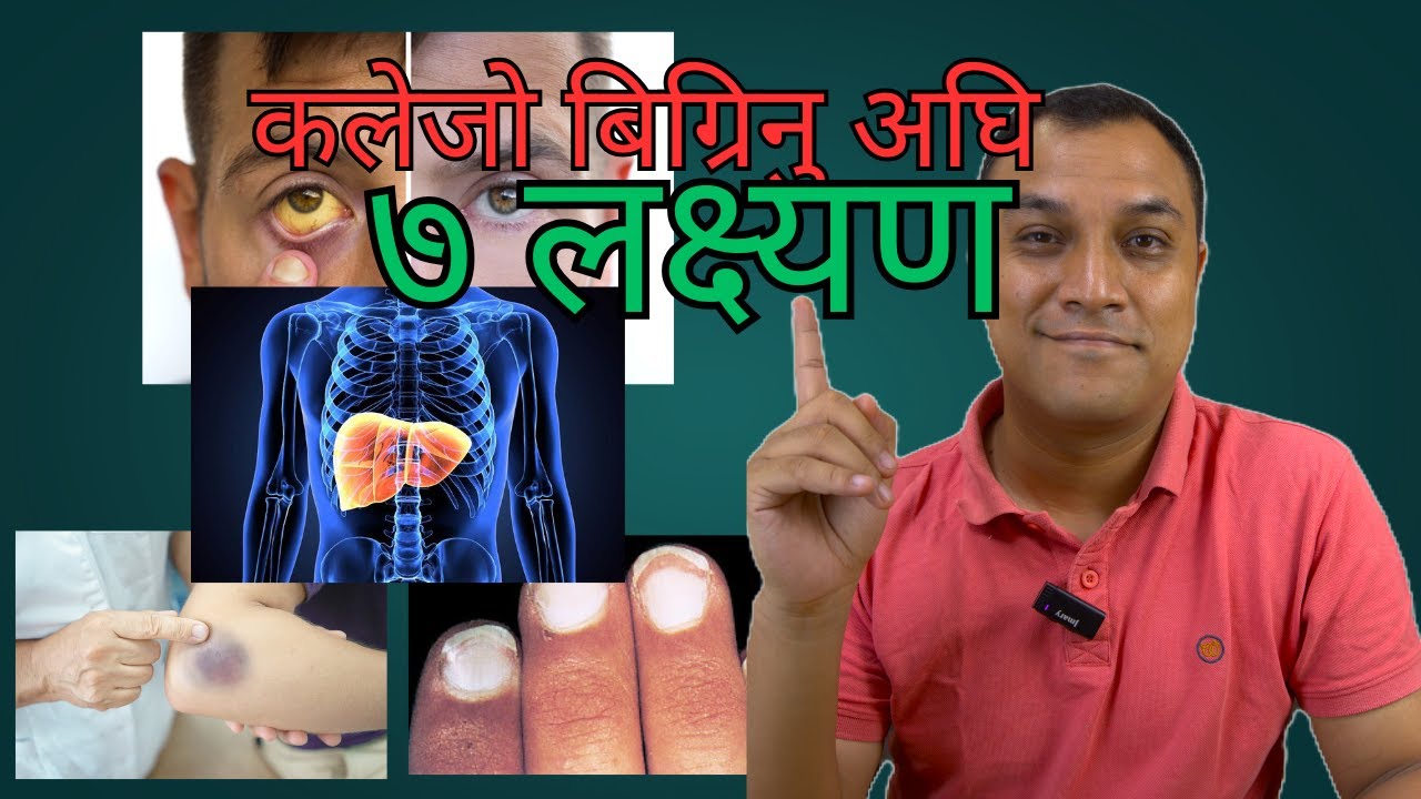 कलेजो बिग्रिनु अघि आउने ७ लक्षण। Symptoms the arise before liver failure. - Dr. Diwakar Manandhar