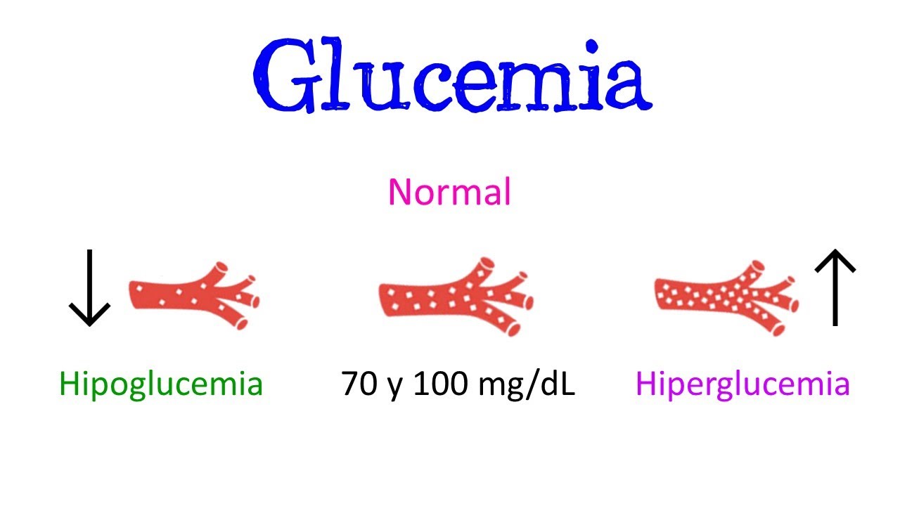 💥 Glucemia, Hipoglucemia e Hiperglucemia 💥 &iquest;Qu&eacute; son? Caracter&iacute;sticas y S&iacute;ntomas  [F&aacute;cil y R&aacute;pido]
