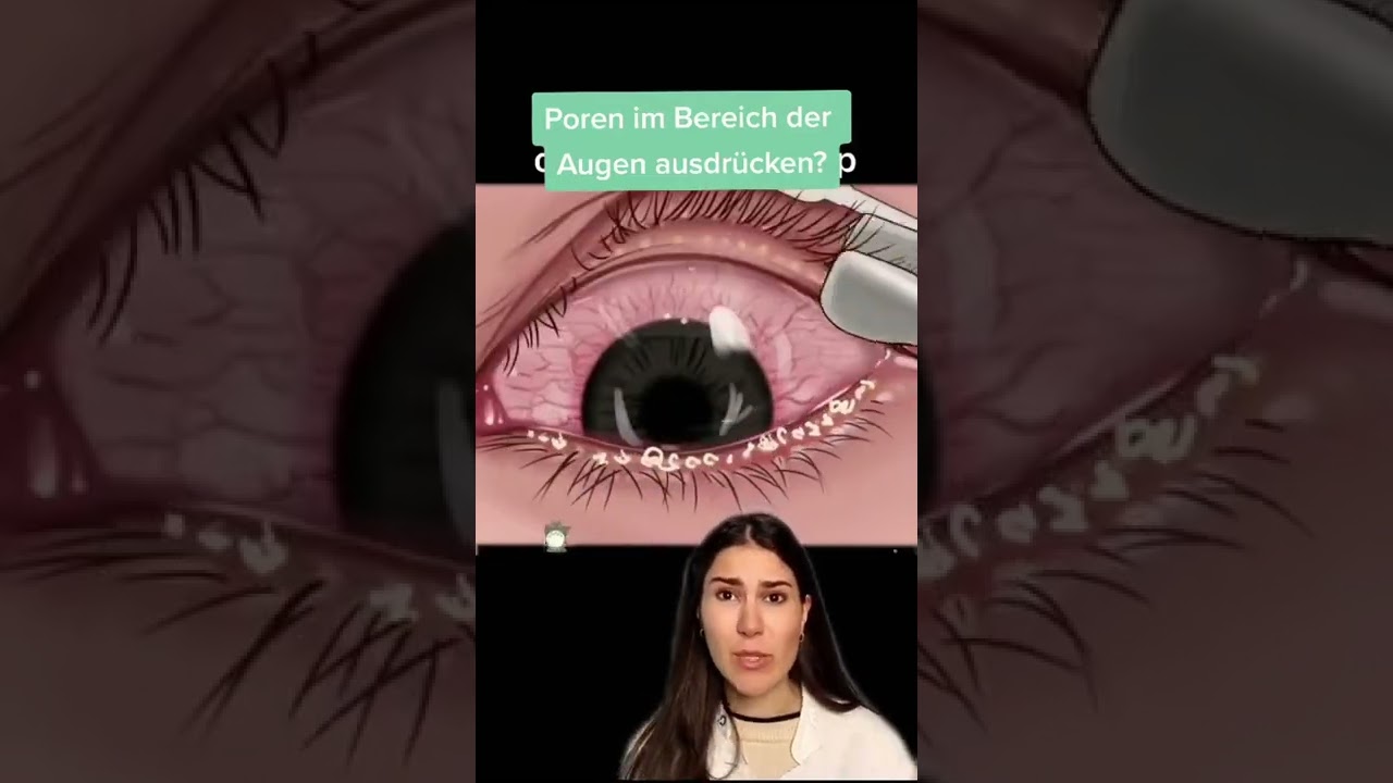 Poren im Bereich der Augen ausdr&uuml;cken? 👀│Dr. med. Alice Martin #short