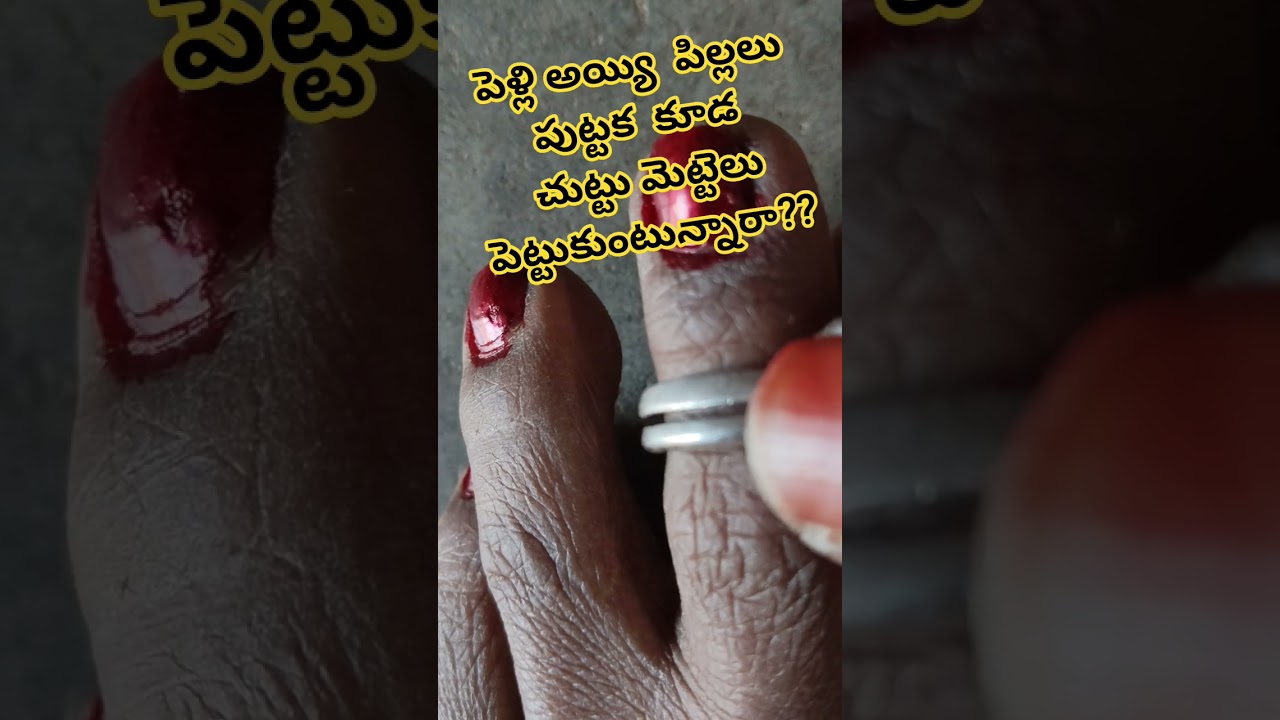 పెళ్లి అయ్యి పిల్లలు పుట్టక కూడా చుట్టుమెట్టేలు  పెట్టుకుంటున్నారా??