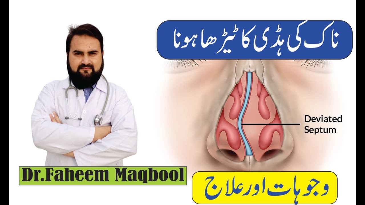 D.N.S Naak ki haddi ka teerapan.ناک کی ہڈی کا ٹیڑھا پن saans ki tangi Dr.Faheem Maqbool