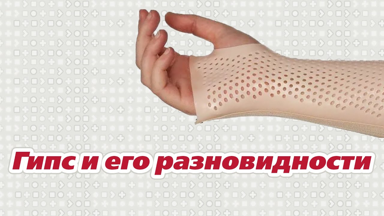 Гипс и его разновидности