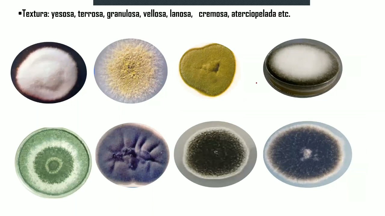 Sesión Practica 3- Micología :ESTUDIO MACROSCÓPICO Y MICROSCÓPICO DE HONGOS AMBIENTALES Y LEVADURAS
