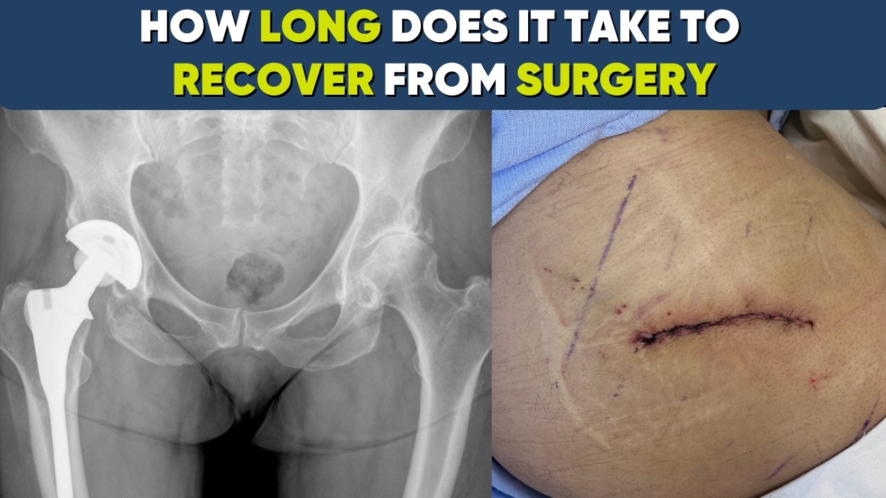 Recovery from Hip Replacement: A Journey Towards Renewed Mobility