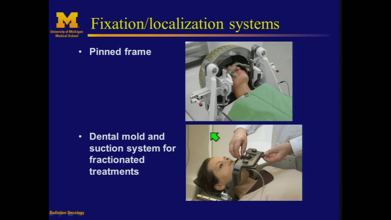 SRS/SBRT - Delivery Systems: Gamma Knife, Cyberknife, and ViewRay - By  James Balter, Ph.D