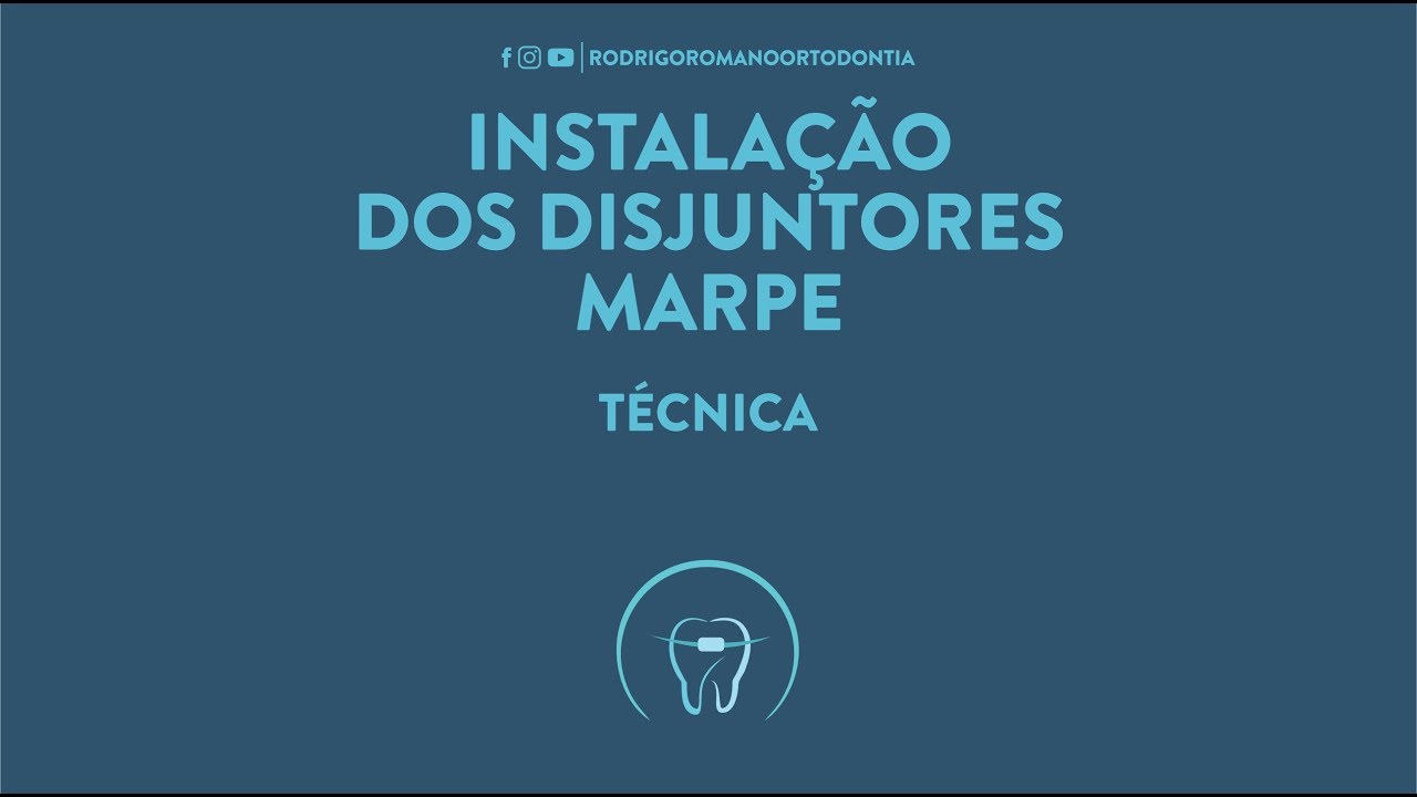 Instalação dos disjuntores marpe -Técnica Ortodôntica