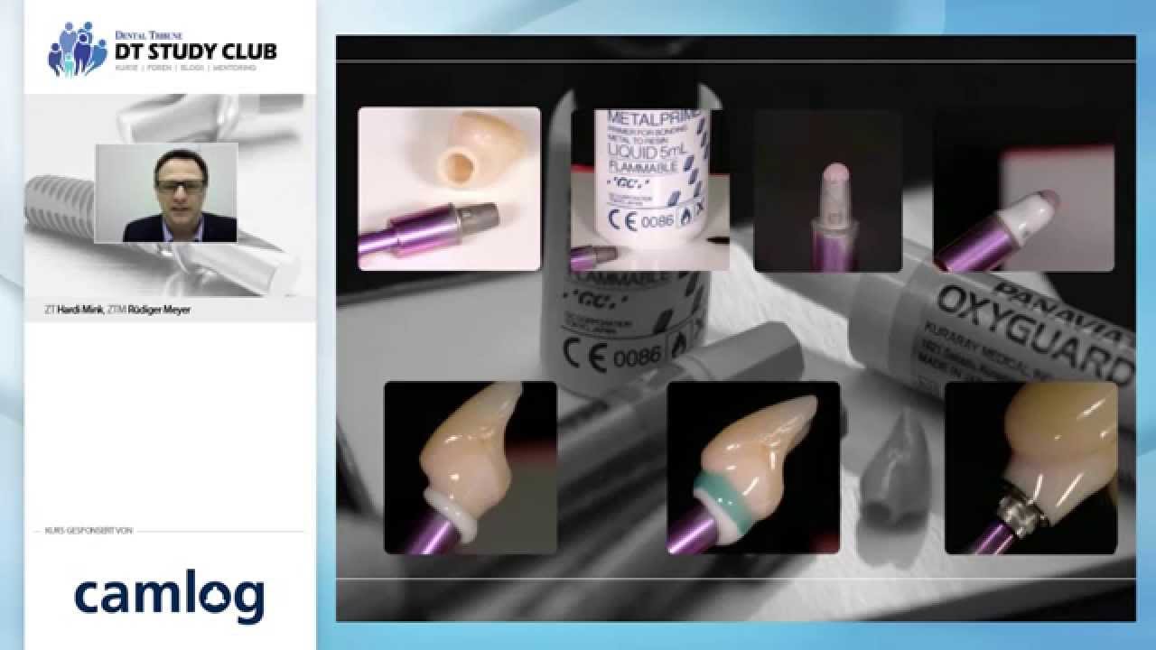 Webinar: DEDICAM - die CAD-CAM L&ouml;sung von CAMLOG: Potentiale f&uuml;r Ihren Erfolg