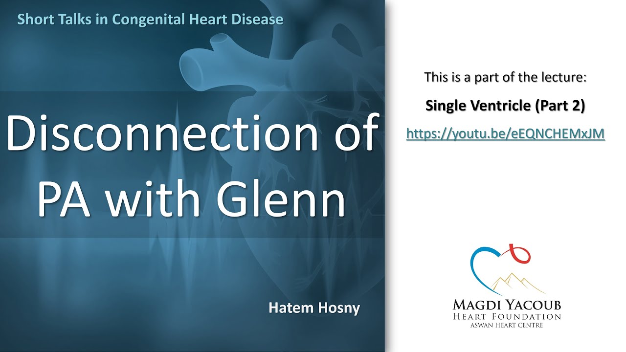 Disconnection of PA with Glenn - Hatem Hosny
