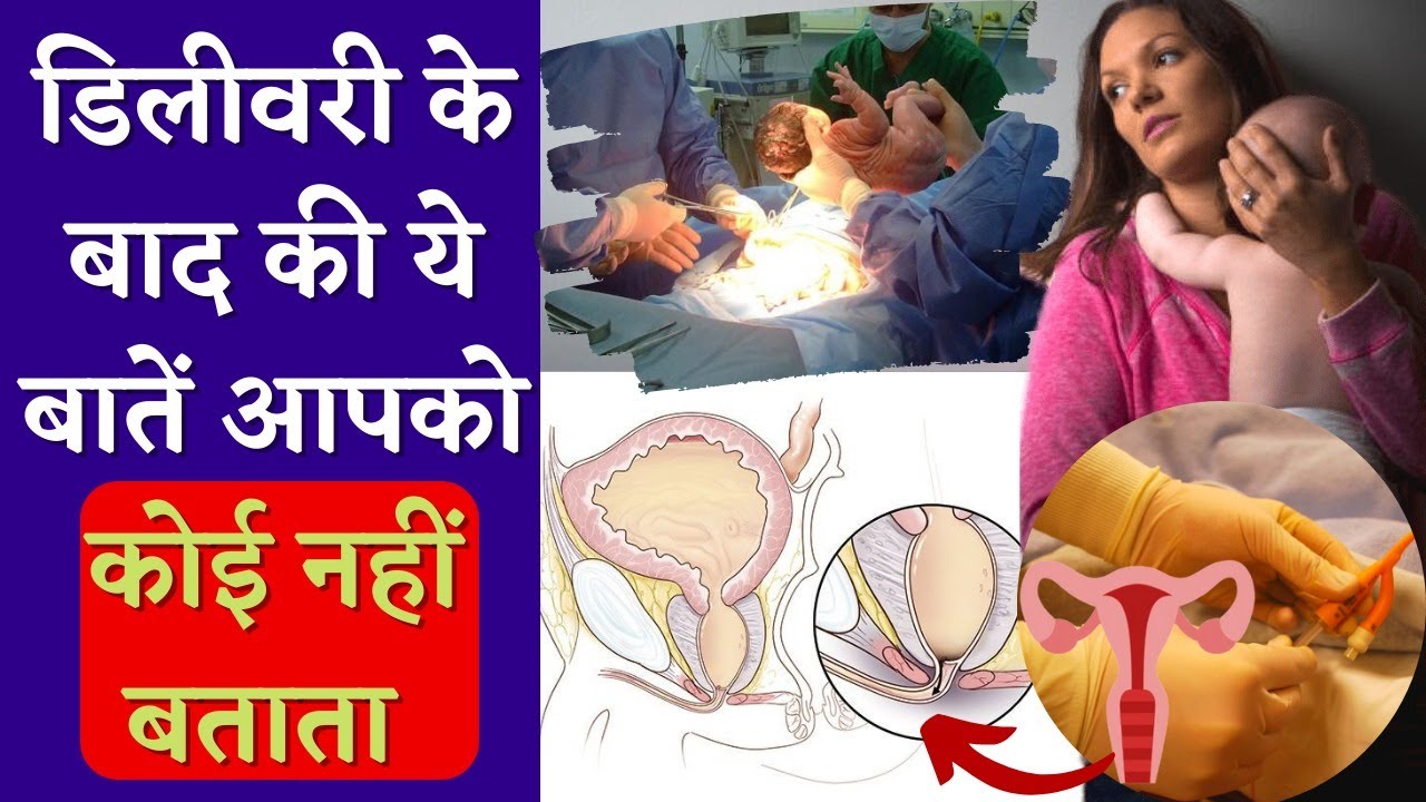डिलीवरी के बाद की ये बातें आपको कोई नहीं बताता 😅🥹 Postpartum Care Tips in Hindi