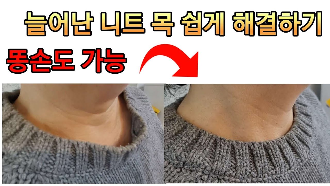 니트 목이 늘어났다고 버리나요? 쉽게 해결하는 방법이 있답니다.