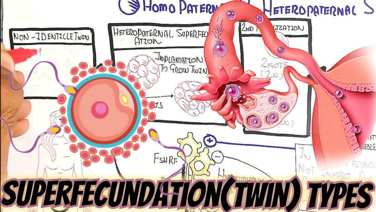 Superfecundation(Twin)Homo Vs Heteropaternal @umerfarooqbiology7083