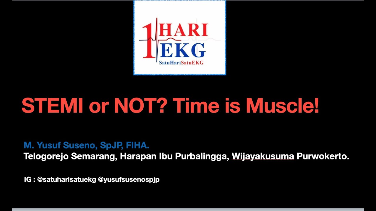 STEMI or NOT? Time Is Muscle! STEMI Criteria vs Acute Occlusion Myocardial Infarction Criteria.