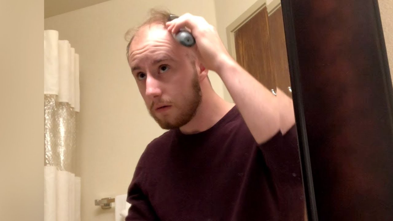 BALDING YOUNG - GOING BALD Shaving My Head From Now On - LIVE 13
