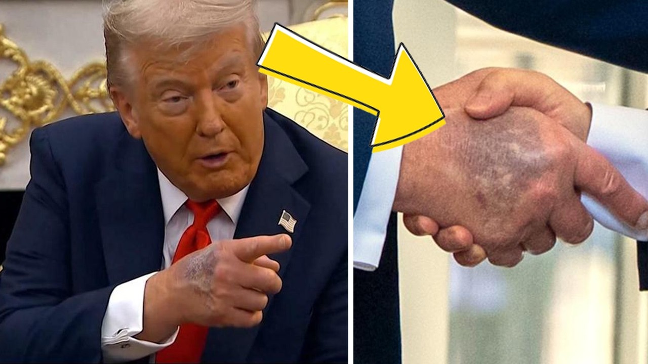 Trump's health under scrutiny