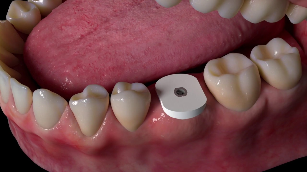 Cervico by VPI. Инструкция по применению