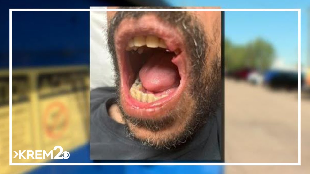 Gay Idaho couple recovering after attack in Caldwell, police say