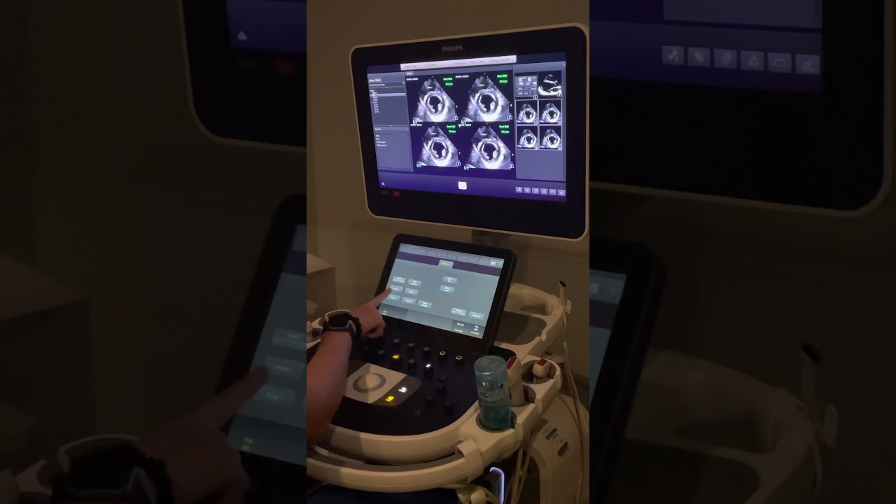 Preparing stress echo-Epiq