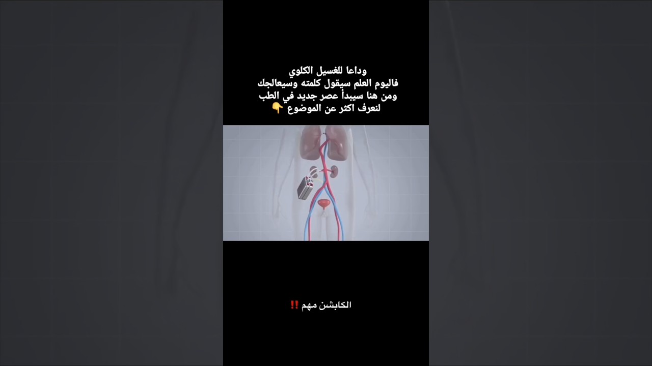 وداعا للغسيل الكلوي  قفزة علمية #اكسبلور #المغرب_الجزائر #المغرب_إسبانيا