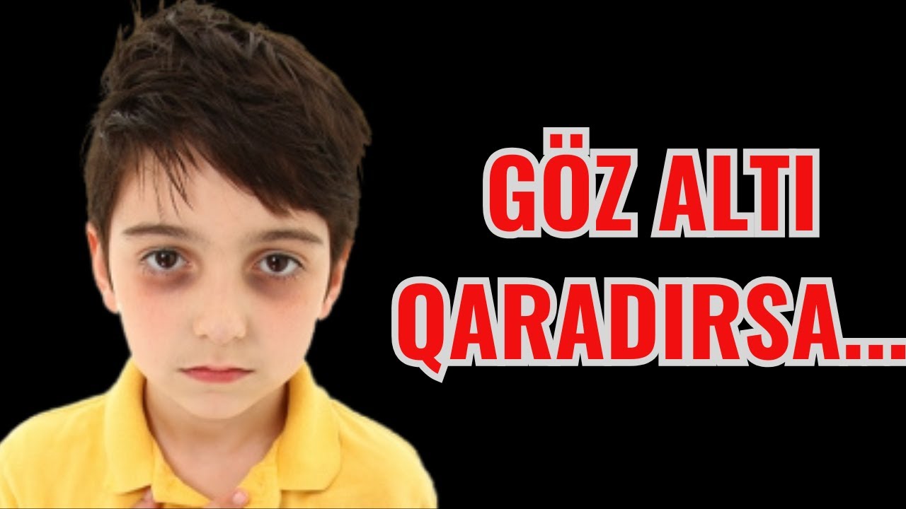 Uşaqların Gözlərinin Altı Niyə Qaralır? - Böyrək Xəstəliyi...