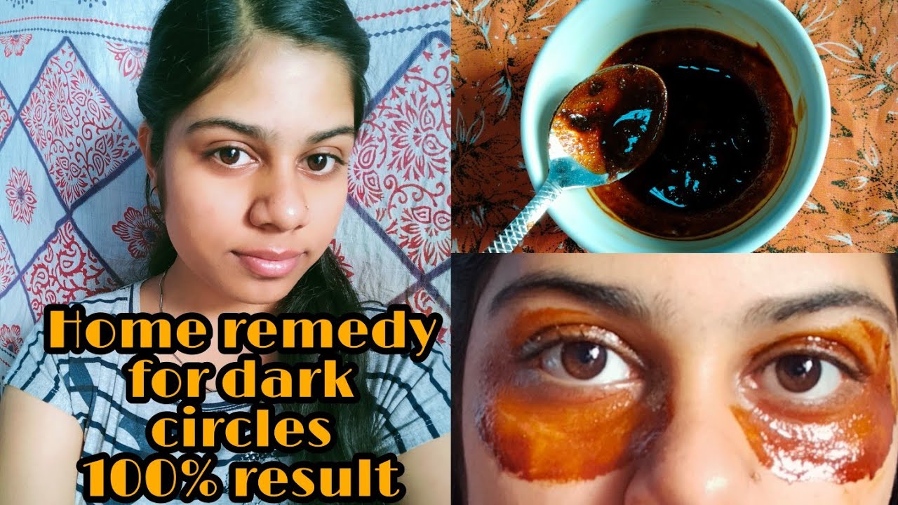 How to remove dark circles naturally in tamil / home remedy for removing dark circles