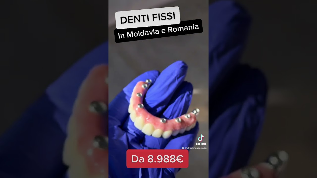 DENTI FISSI SU 12 IMPIANTI #dottorpalmas #dentifissi #dentifissiin24ore
