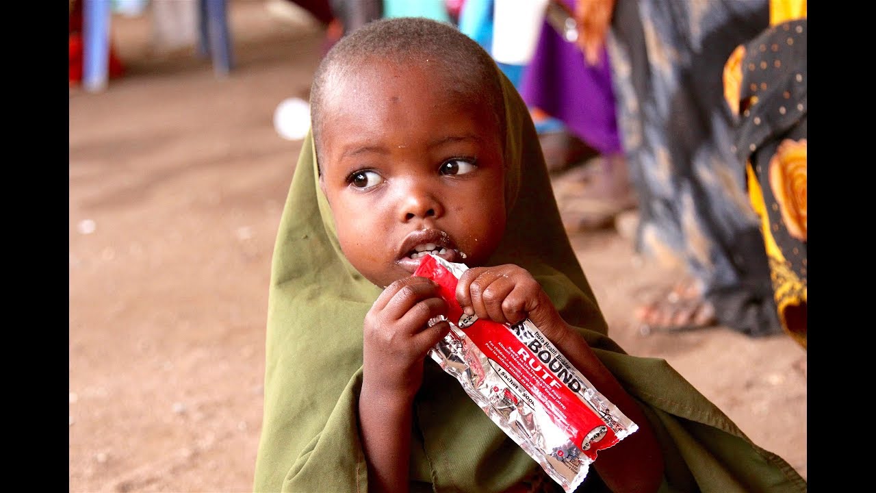 UNICEF and DFID work together to save malnourished Somali children