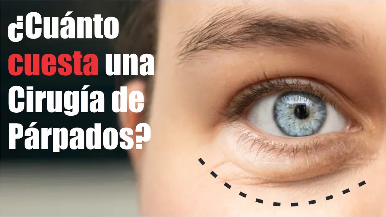 ¿Cuánto CUESTA una BLEFAROPLASTÍA? 👀 EL PRECIO de una CIRUGÌA DE PÁRPADOS 🔥 Dr JIMMY PUMAMANGO