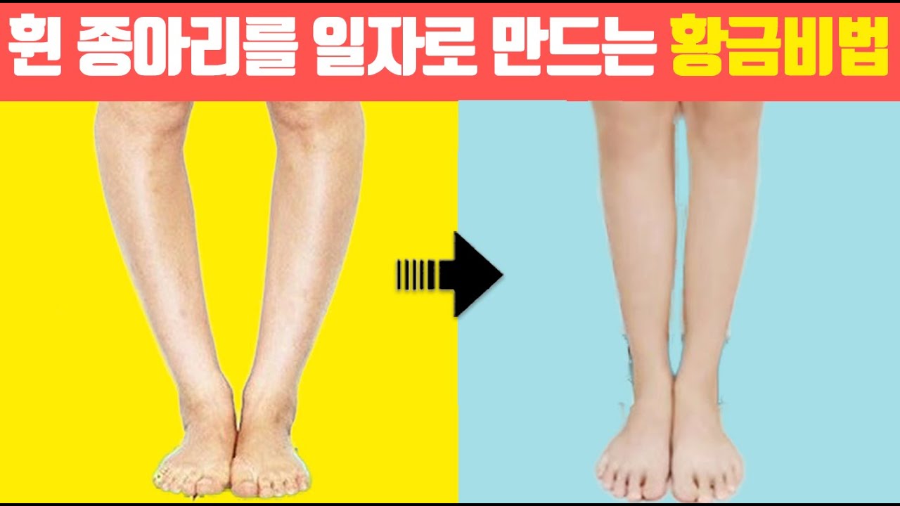 👑휘어진 종아리알 11자 만드는 황금비법👑 / 오다리교정,휜다리교정,비골두교정,휘어진다리