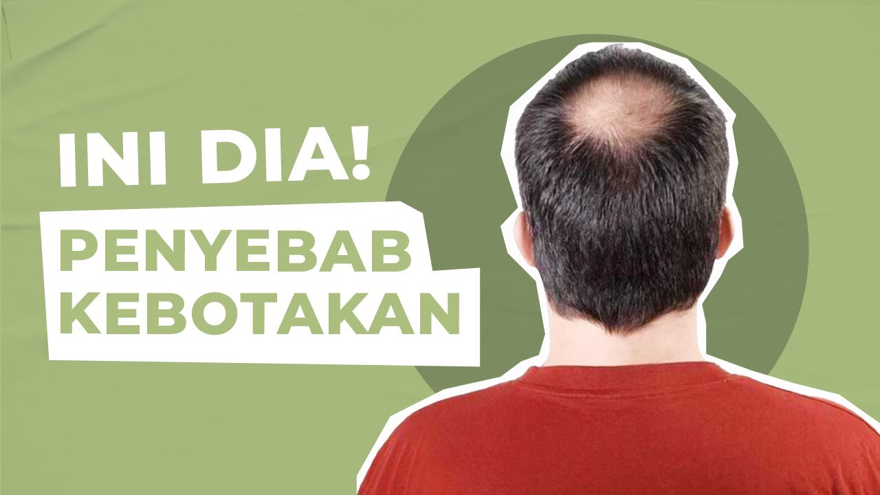 Pahami Betul! Inilah Penyebab Beberapa Pria Botak dan Lainnya Tidak