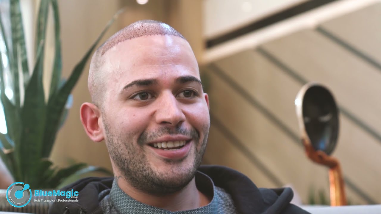 Trapianto Capelli Turchia | Ecco L' esperienza di Mattia Sifit a Istanbul