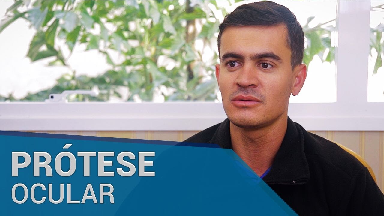 Cirurgia de Evisceração e Adaptação de Prótese Ocular | Depoimento | Clínica Dr. André Borba