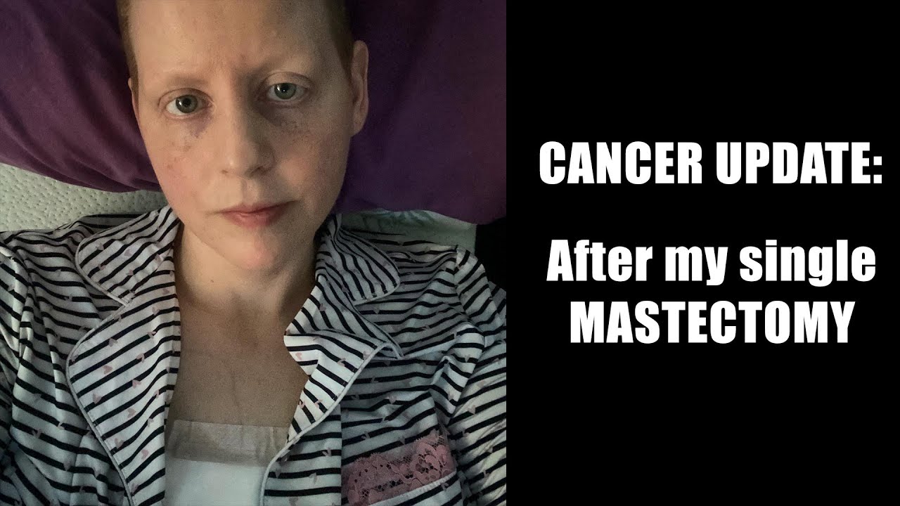 My Single Mastectomy || Cancer Update