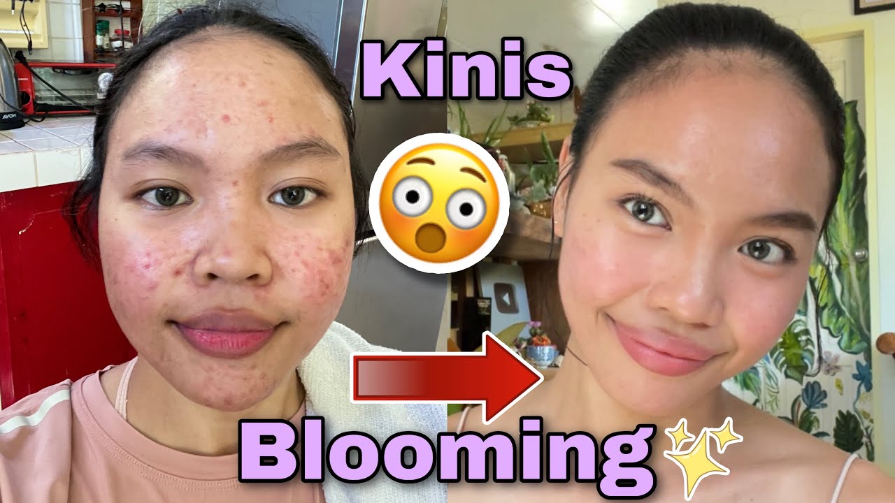 MOST REQUESTED! MY SKINCARE ROUTINE ✨