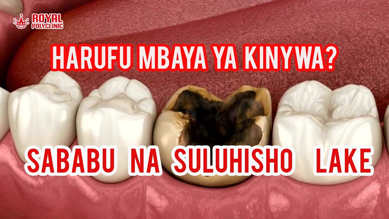 MENO NA KINYWA VISIPOJALIWA HUSABABISHA MAGONJWA HATARI