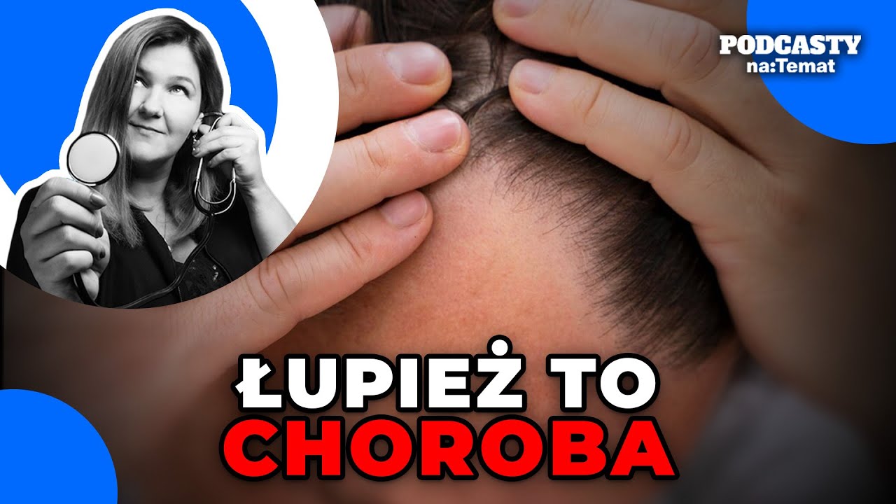 Łupież to choroba, nie zaniedbanie higieniczne. Jak skutecznie z nim walczyć? | ZBC