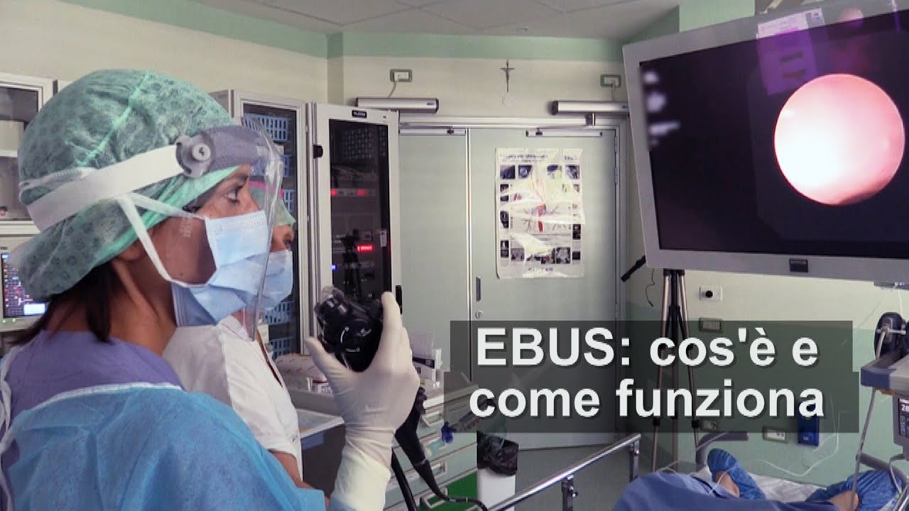 Broncoscopia EBUS: cos'&egrave; e come funziona