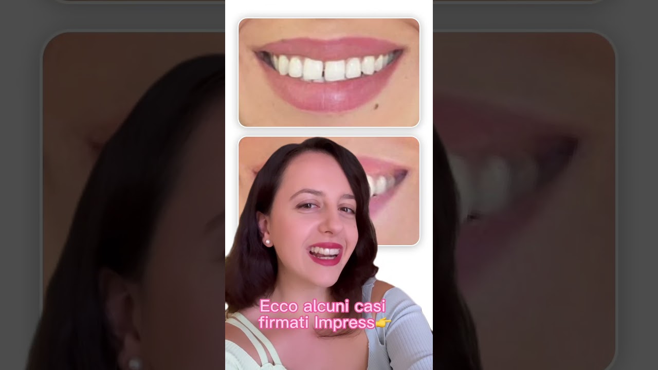 Come correggere i denti storti - Scopri l'ortodonzia invisibile Impress