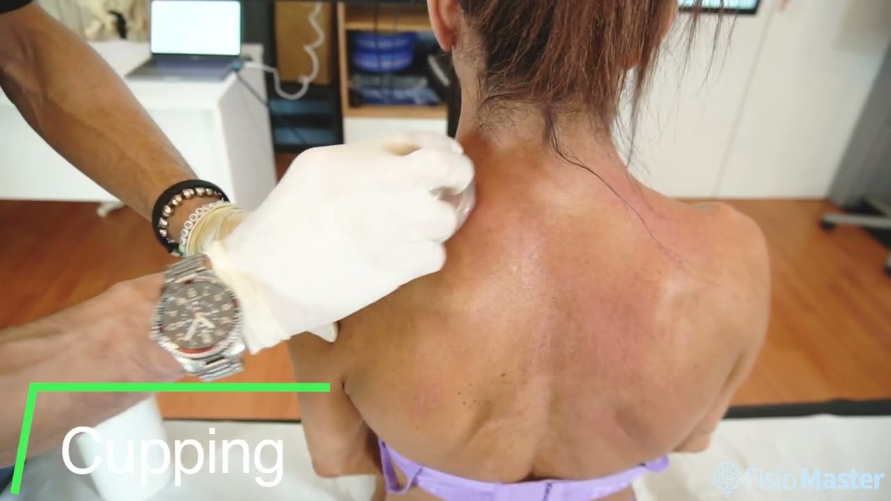 Trailer Terapia Manuale Miofasciale Integrata: Deep Tissue -