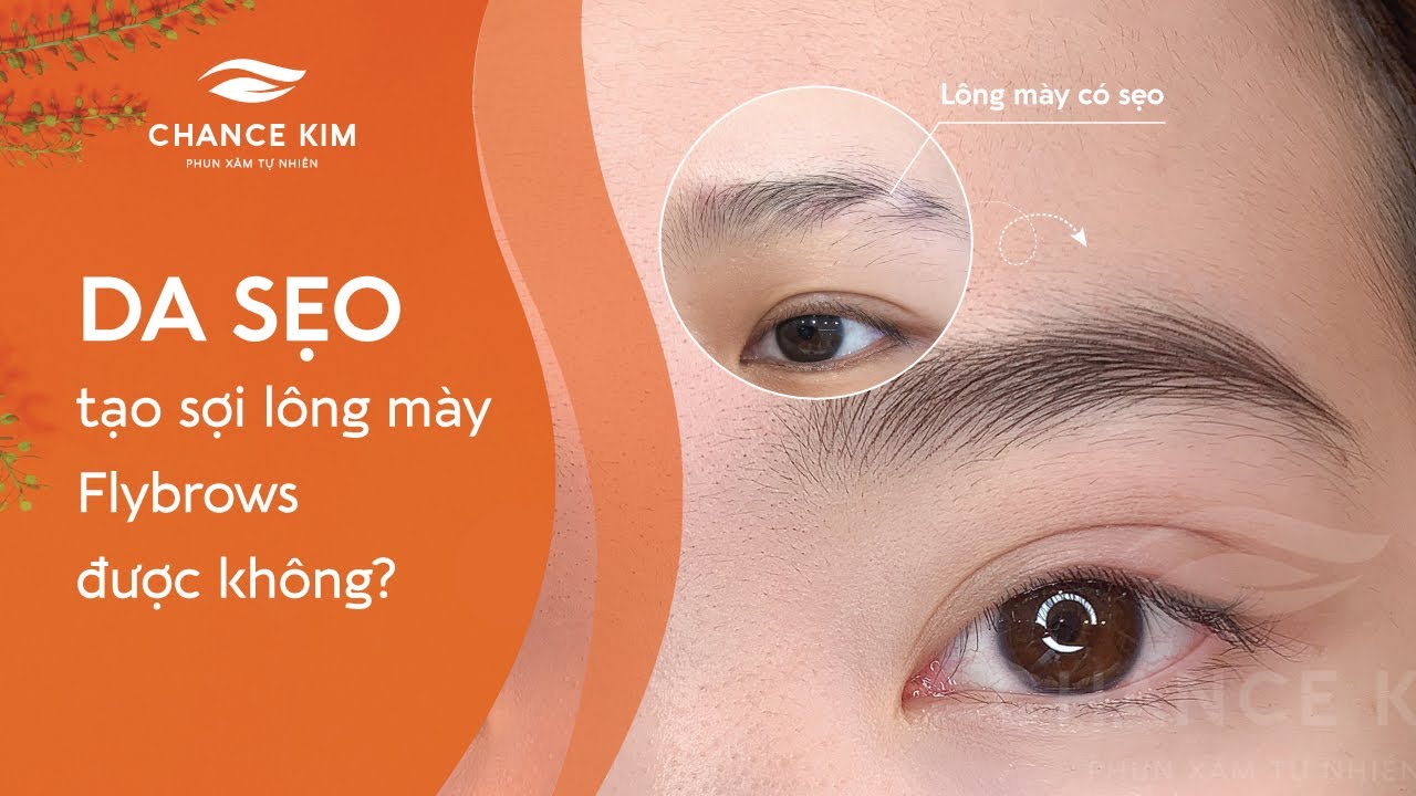 DA SẸO TẠO SỢI LÔNG MÀY FLYBROWS ĐƯỢC KHÔNG? BỊ LỘ KHÔNG?