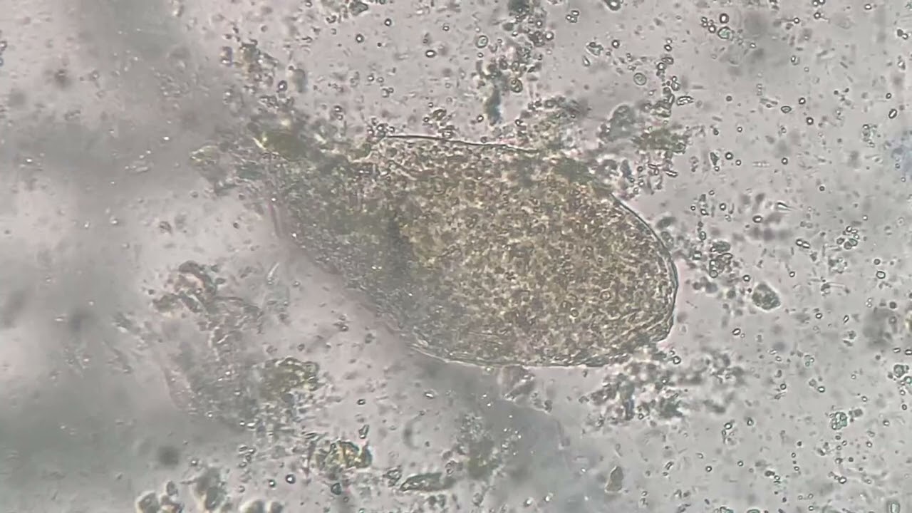 Examen direct des selles ( coprologie parasitaire) #foryou #analyse #pourtoi #control