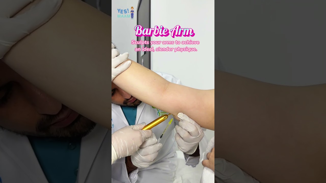 Barbie Arm