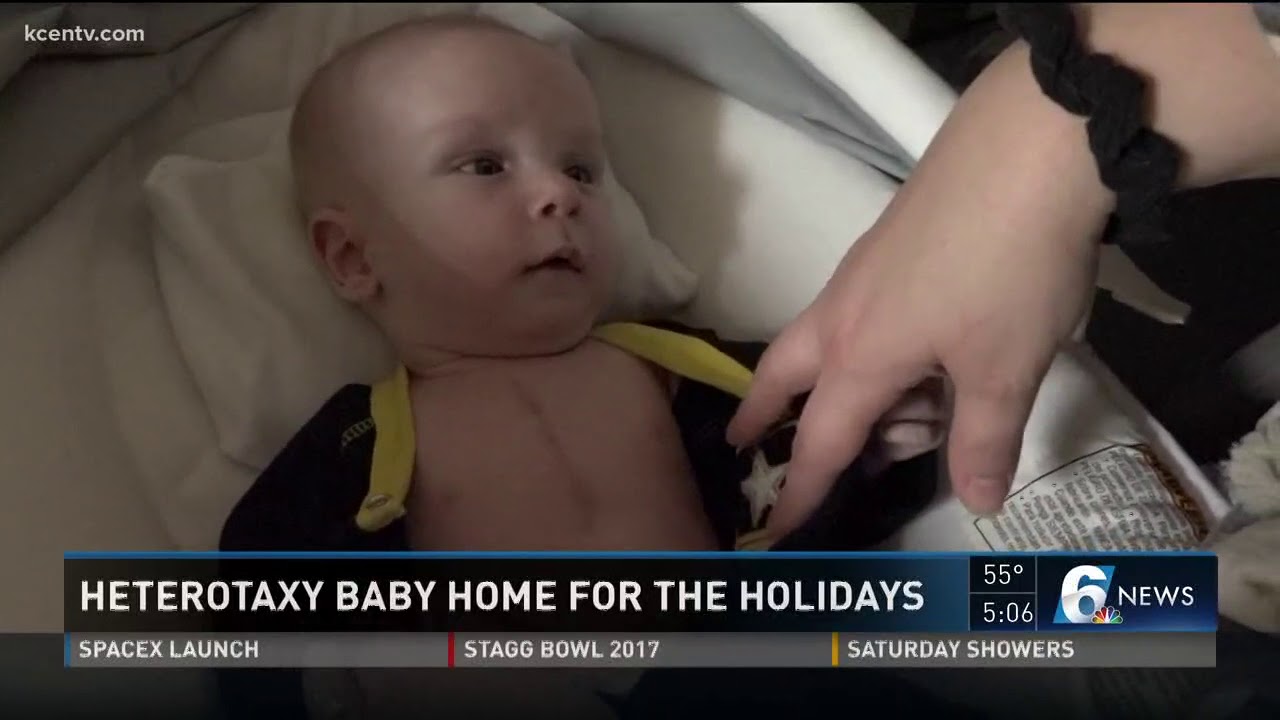 Heterotaxy baby returns home for the holidays