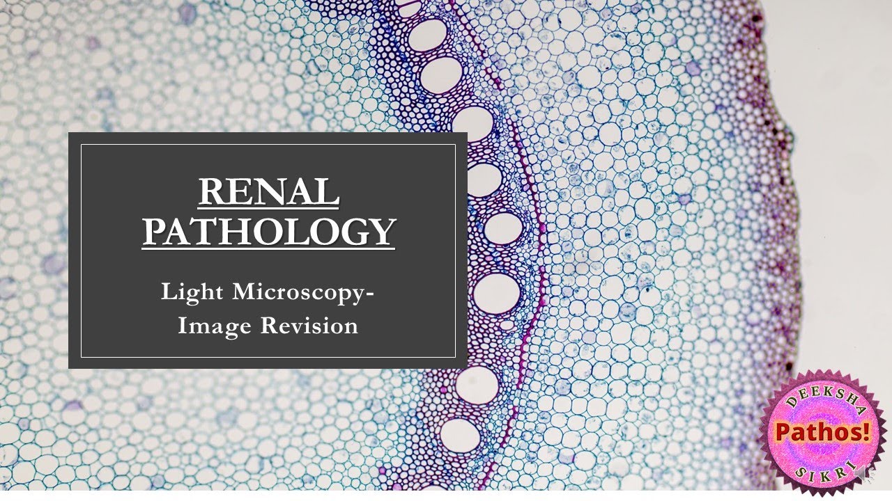 Renal Pathology- Image Based Revision