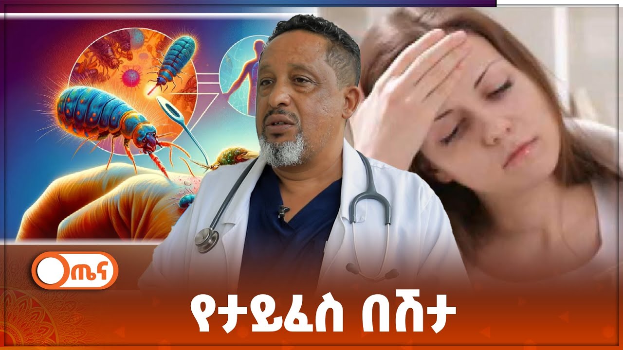 የታይፈስ በሽታ መንስኤ እና ህክምናው