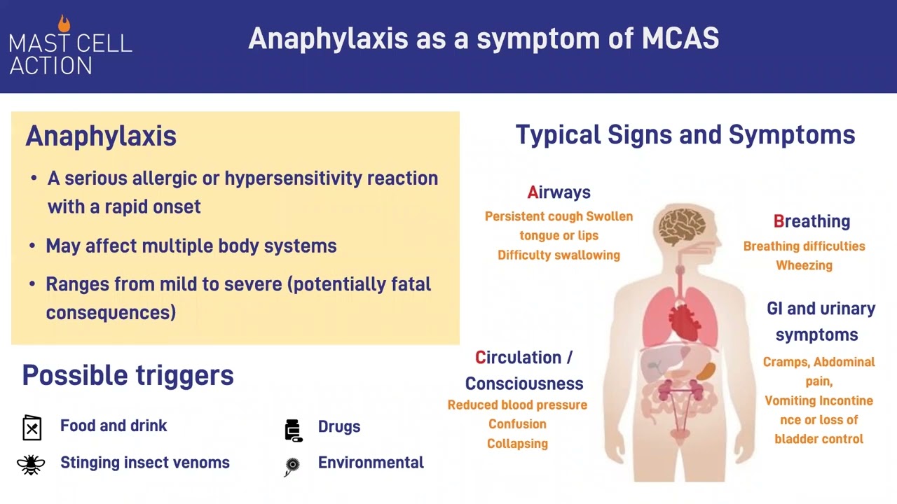 Mast Cell Activation Syndrome (MCAS) information presentation